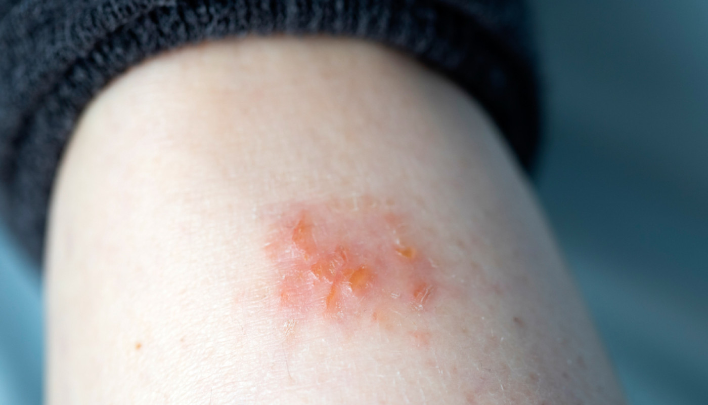 Qui contacter pour couper le feu à Lure et ses environs ?